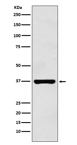 1 - Anti-PIM2 Rabbit Monoclonal Antibody ABO15888