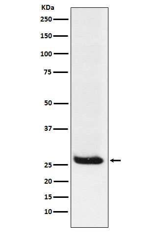 1 - Anti-Hippocalcin Rabbit Monoclonal Antibody ABO15889