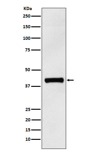 1 - Anti-IL12 p40 Rabbit Monoclonal Antibody ABO15890