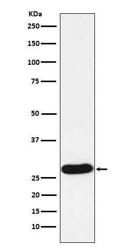 1 - Anti-PR3 Rabbit Monoclonal Antibody ABO15892
