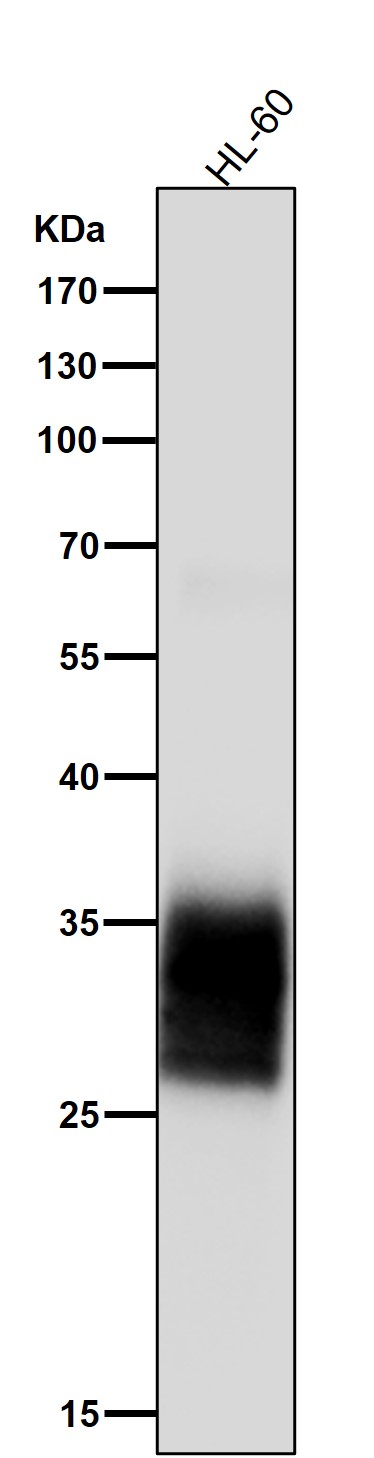 1 - Anti-PR3 Rabbit Monoclonal Antibody ABO15892