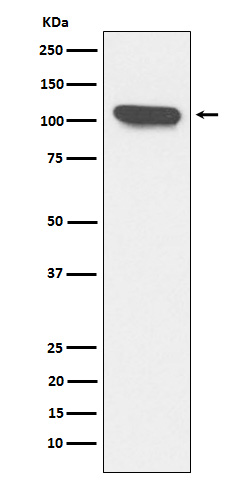 1 - Anti-ERAP1 Rabbit Monoclonal Antibody ABO15895