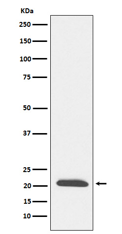1 - Anti-DCTN3 Rabbit Monoclonal Antibody ABO15896