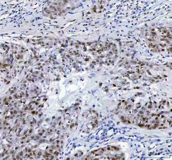 2 - Anti-DP1 Rabbit Monoclonal Antibody ABO15898