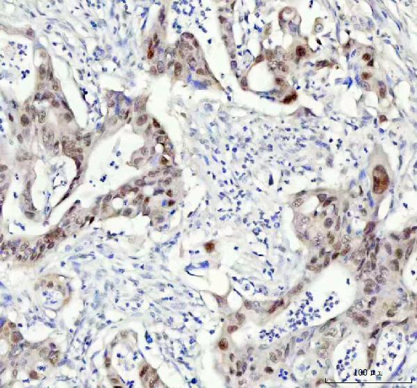 2 - Anti-DP1 Rabbit Monoclonal Antibody ABO15898