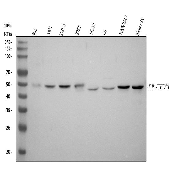 1 - Anti-DP1 Rabbit Monoclonal Antibody ABO15898