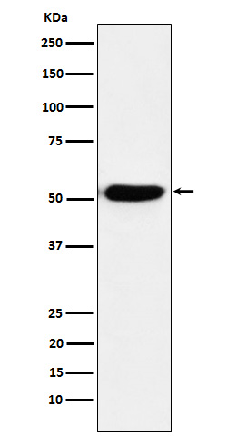 1 - Anti-IRF4 Rabbit Monoclonal Antibody ABO15899