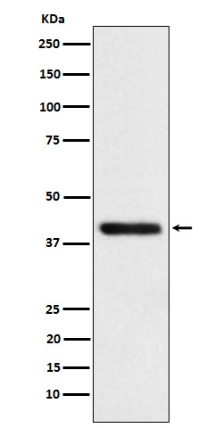 1 - Anti-TMOD2 Rabbit Monoclonal Antibody ABO15904