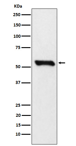 1 - Anti-DLDH Rabbit Monoclonal Antibody ABO15906