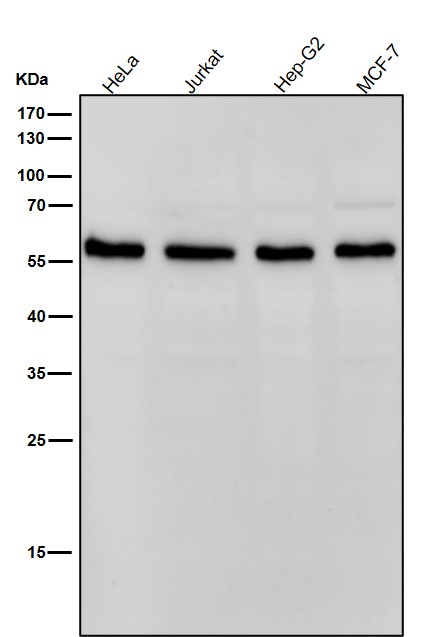 1 - Anti-DLDH Rabbit Monoclonal Antibody ABO15906