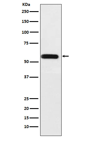 1 - Anti-ANGPTL3 Rabbit Monoclonal Antibody ABO15909