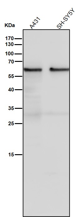 1 - Anti-ANGPTL3 Rabbit Monoclonal Antibody ABO15909