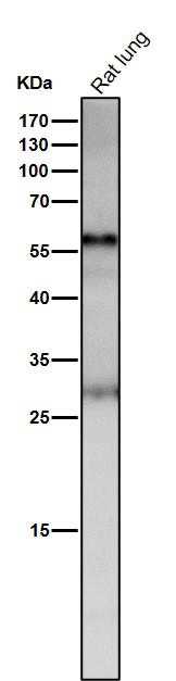 1 - Anti-ANGPTL3 Rabbit Monoclonal Antibody ABO15909