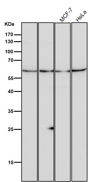 1 - Anti-ANGPTL3 Rabbit Monoclonal Antibody ABO15909