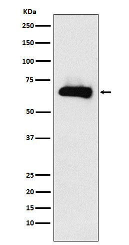 1 - Anti-CRMP4 Rabbit Monoclonal Antibody ABO15910