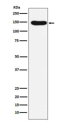 1 - Anti-Desmoglein 3 Rabbit Monoclonal Antibody ABO15911