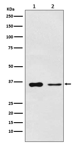 1 - Anti-PDLIM1 Rabbit Monoclonal Antibody ABO15912