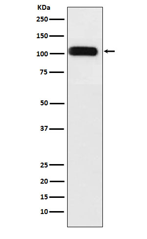 1 - Anti-SERCA1 ATPase Rabbit Monoclonal Antibody ABO15913