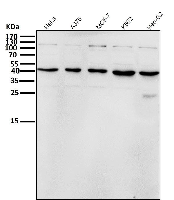 1 - Anti-Inhibin beta A Rabbit Monoclonal Antibody ABO15914