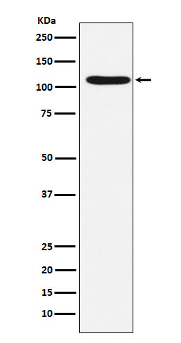 1 - Anti-HIRA Rabbit Monoclonal Antibody ABO15915