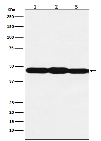 1 - Anti-ESE1 Rabbit Monoclonal Antibody ABO15917