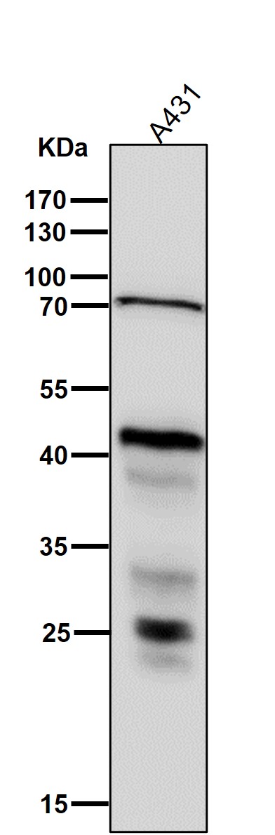 1 - Anti-ESE1 Rabbit Monoclonal Antibody ABO15917