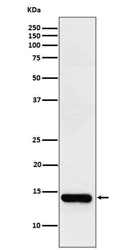 1 - Anti-FABPI Rabbit Monoclonal Antibody ABO15918
