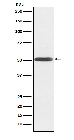 1 - Anti-Inhibin beta B Rabbit Monoclonal Antibody ABO15919