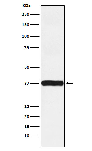 1 - Anti-Arp2 Rabbit Monoclonal Antibody ABO15920