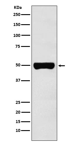 1 - Anti-CHX10 Rabbit Monoclonal Antibody ABO15921