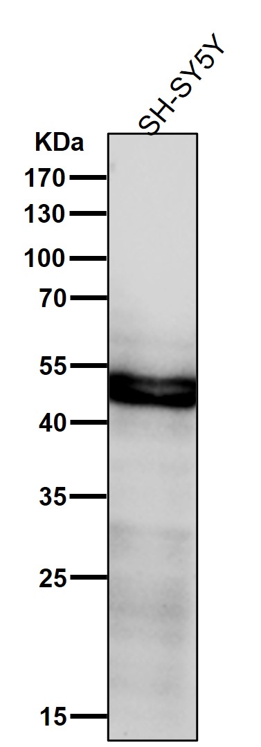 1 - Anti-CHX10 Rabbit Monoclonal Antibody ABO15921