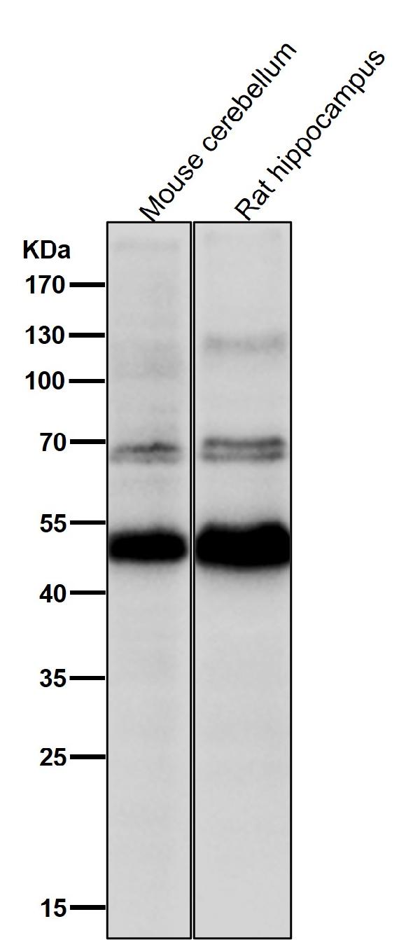 1 - Anti-CHX10 Rabbit Monoclonal Antibody ABO15921