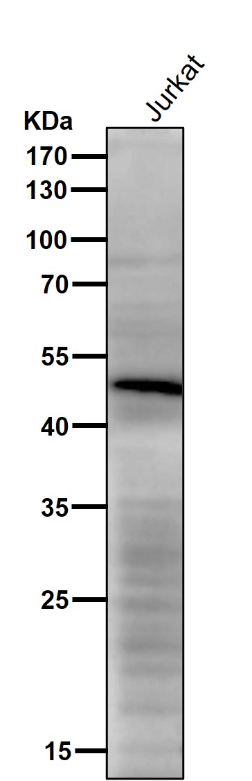 1 - Anti-CHX10 Rabbit Monoclonal Antibody ABO15921