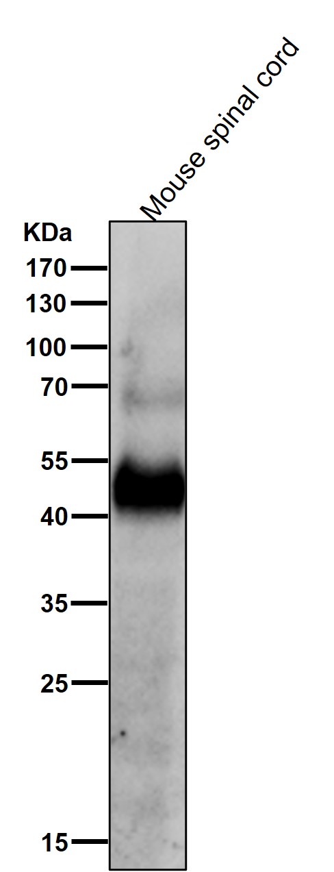 1 - Anti-CHX10 Rabbit Monoclonal Antibody ABO15921