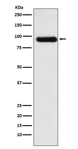 1 - Anti-ACVR2A Rabbit Monoclonal Antibody ABO15923