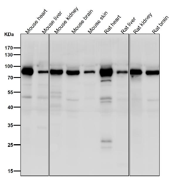1 - Anti-ACVR2A Rabbit Monoclonal Antibody ABO15923