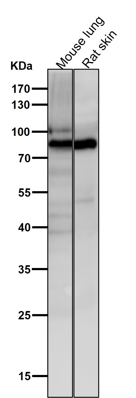 1 - Anti-ACVR2A Rabbit Monoclonal Antibody ABO15923