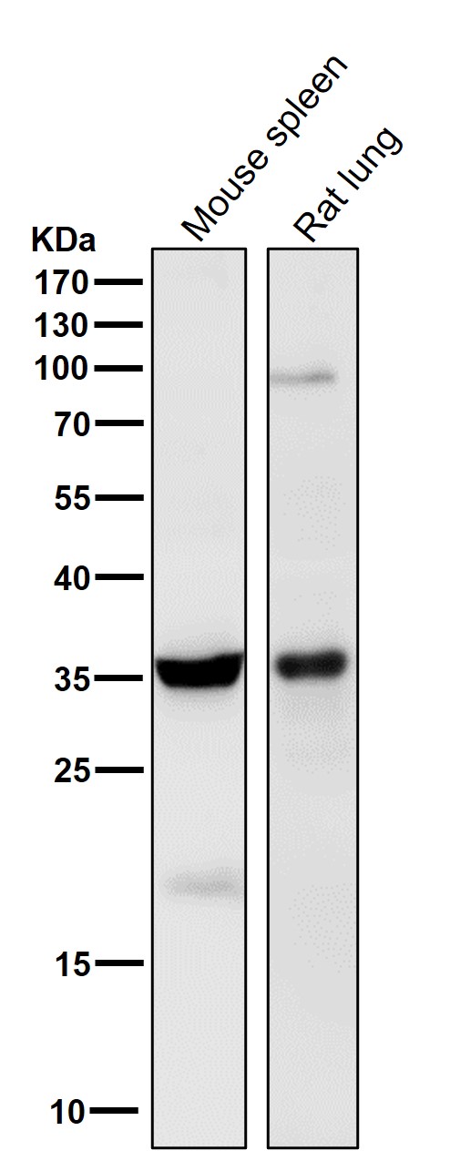 1 - Anti-5HT7 Receptor Rabbit Monoclonal Antibody ABO15924
