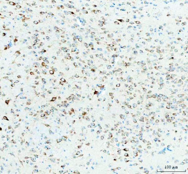 2 - Anti-FXR1 Rabbit Monoclonal Antibody ABO15925