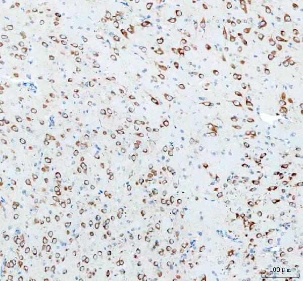 2 - Anti-FXR1 Rabbit Monoclonal Antibody ABO15925