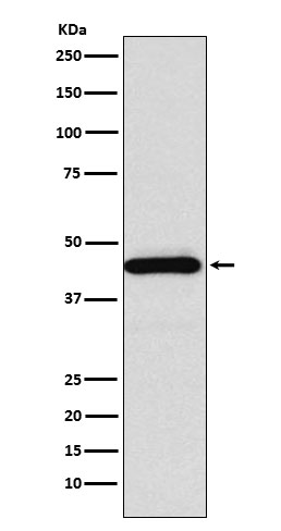 1 - Anti-SSTR5 Rabbit Monoclonal Antibody ABO15926