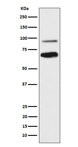 1 - Anti-TCF4 Rabbit Monoclonal Antibody ABO15930