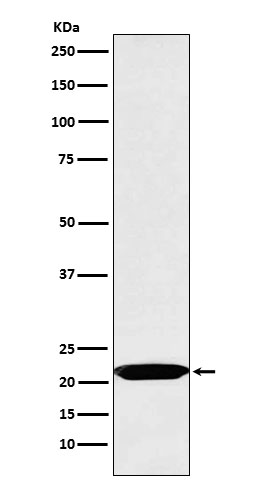 1 - Anti-Oncostatin M Rabbit Monoclonal Antibody ABO15932