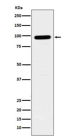 1 - Anti-GLB1 Rabbit Monoclonal Antibody ABO15933