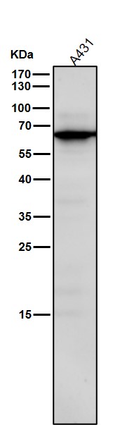 1 - Anti-STK39 Rabbit Monoclonal Antibody ABO15938