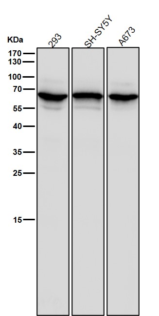 1 - Anti-STK39 Rabbit Monoclonal Antibody ABO15938
