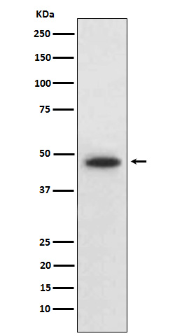 1 - Anti-Wnt5b Rabbit Monoclonal Antibody ABO15939