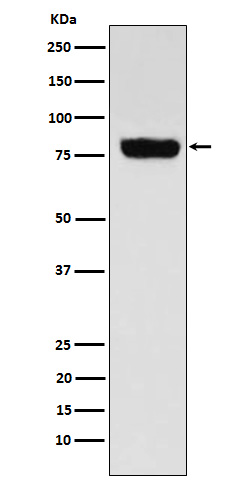1 - Anti-SLC22A3 Rabbit Monoclonal Antibody ABO15940