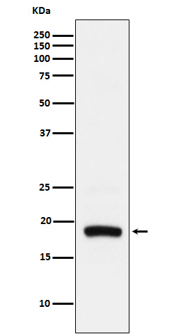 1 - Anti-ARF5 Rabbit Monoclonal Antibody ABO15944