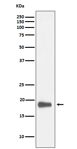 1 - Anti-HMGN2 Rabbit Monoclonal Antibody ABO15945